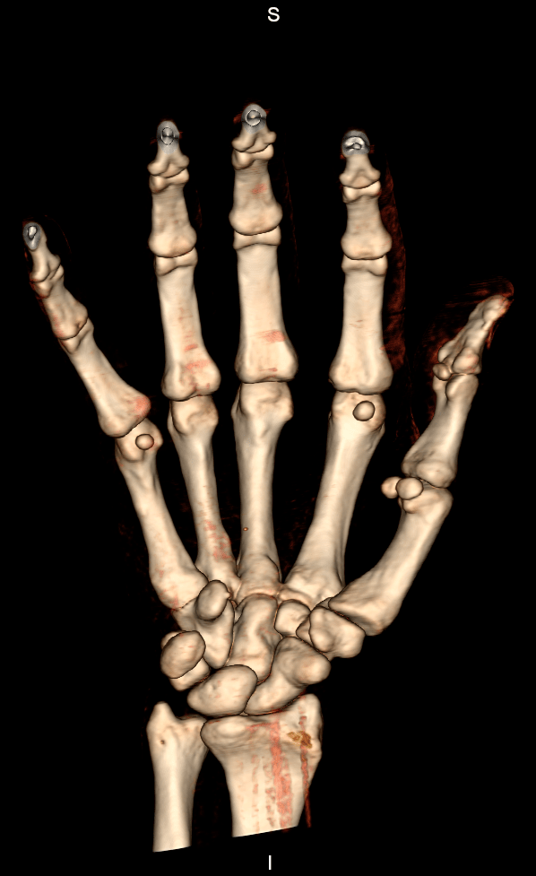 3D MÃO FRONTAL 3D MÃO FRONTAL