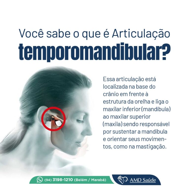Tomografia Temporomandibular
