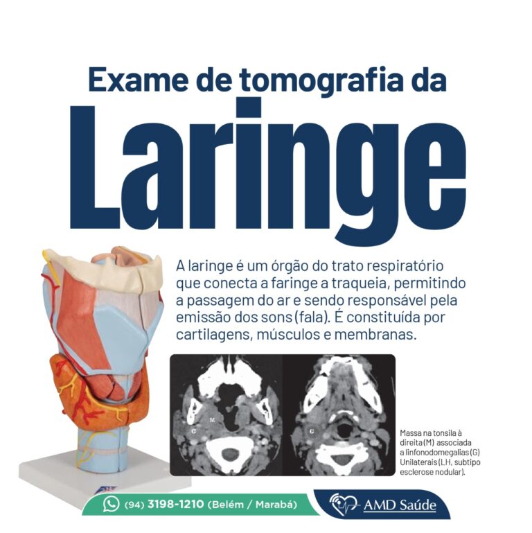 Tomografia da laringe