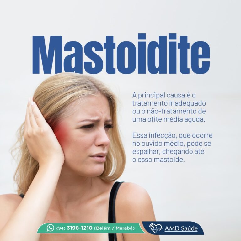 Mastoidite