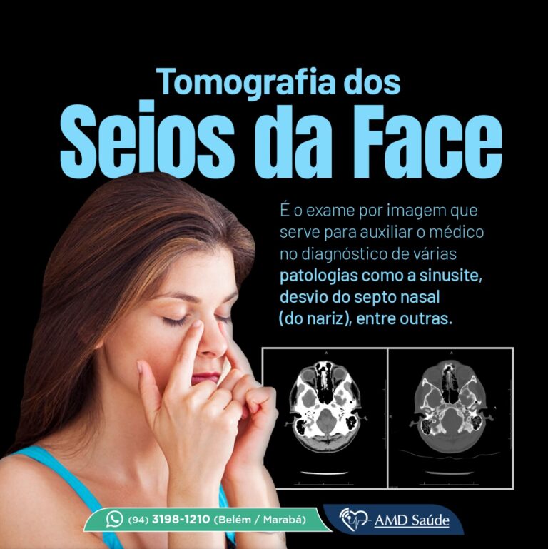 Tomografia de Seios da Face