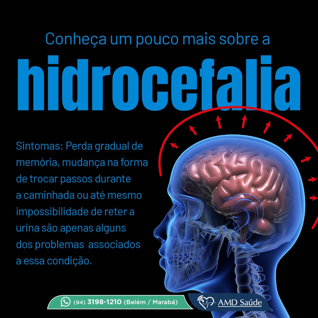 Hidrocefalia • Amd Saúde 0978